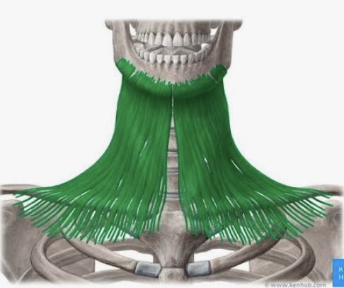 <p>Which muscle is this?</p>