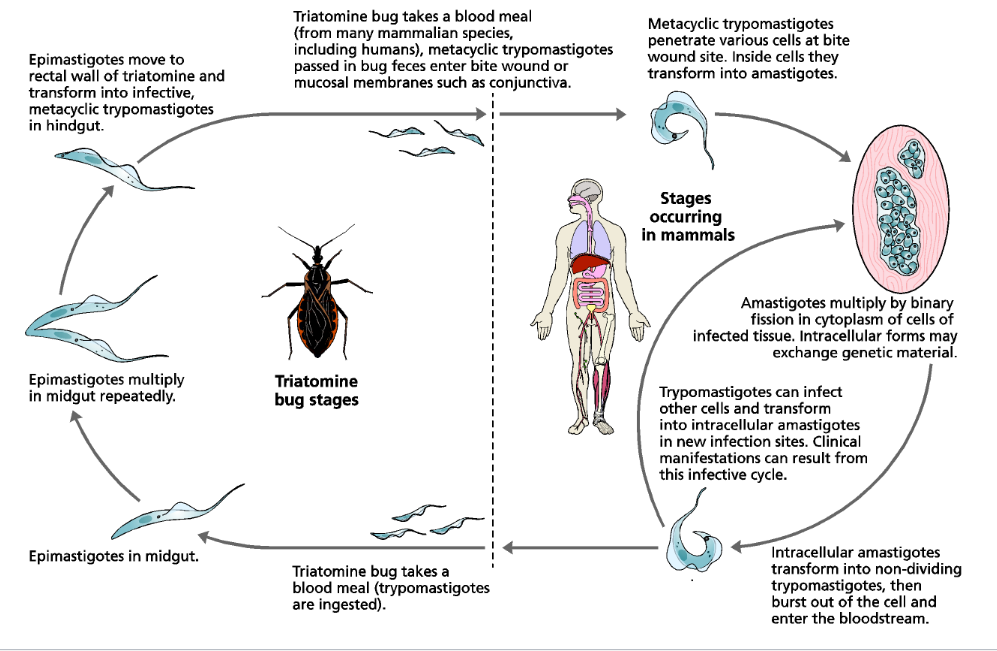 <p>Chagas Disease causing a eye swollen shut. Acute is fever, body aches, and GI issues. Chronic: hypercardia, megaesophagus and megacolon which have might morbidity and mortality. </p>