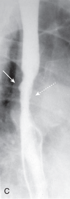 <p>diagnosis</p>