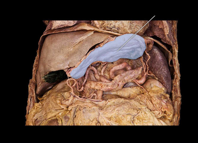 <p><span>Identify the highlighted digestive system structure.</span></p><p> </p><p>spleen</p><p> </p><p>gallbladder</p><p> </p><p>stomach</p><p> </p><p>liver</p>
