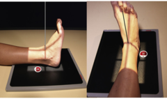 <p>kVp: 60-75</p><p>Grid: No</p><p>CR: directed midway between malleoli</p><p>Patient position: Patient supine, leg fully extended, Do not dorsiflex foot allow it to remain in natural position, Internally rotate leg & foot 15-20°</p><p>Evaluation criteria: Distal ⅓ of tibia and fibula demonstrated, Proximal ½ of metatarsals included, Medial and superior aspect of ankle joint open</p>