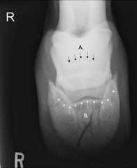 <p>Identify the labeled joints, A and B</p>