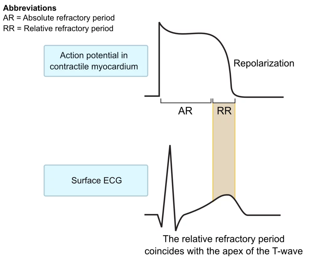 <p><strong>Relative refractory period of ventricular repolarization</strong></p>