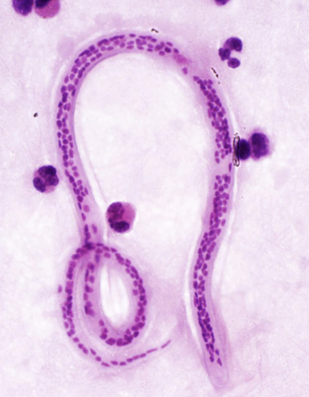 <p>What parasite is this?</p>