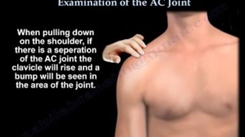 <p>Find the end of the collarbone near the shoulder. Push it down with your finger, then let go. If it bounces back up like a button, it’s positive.</p>