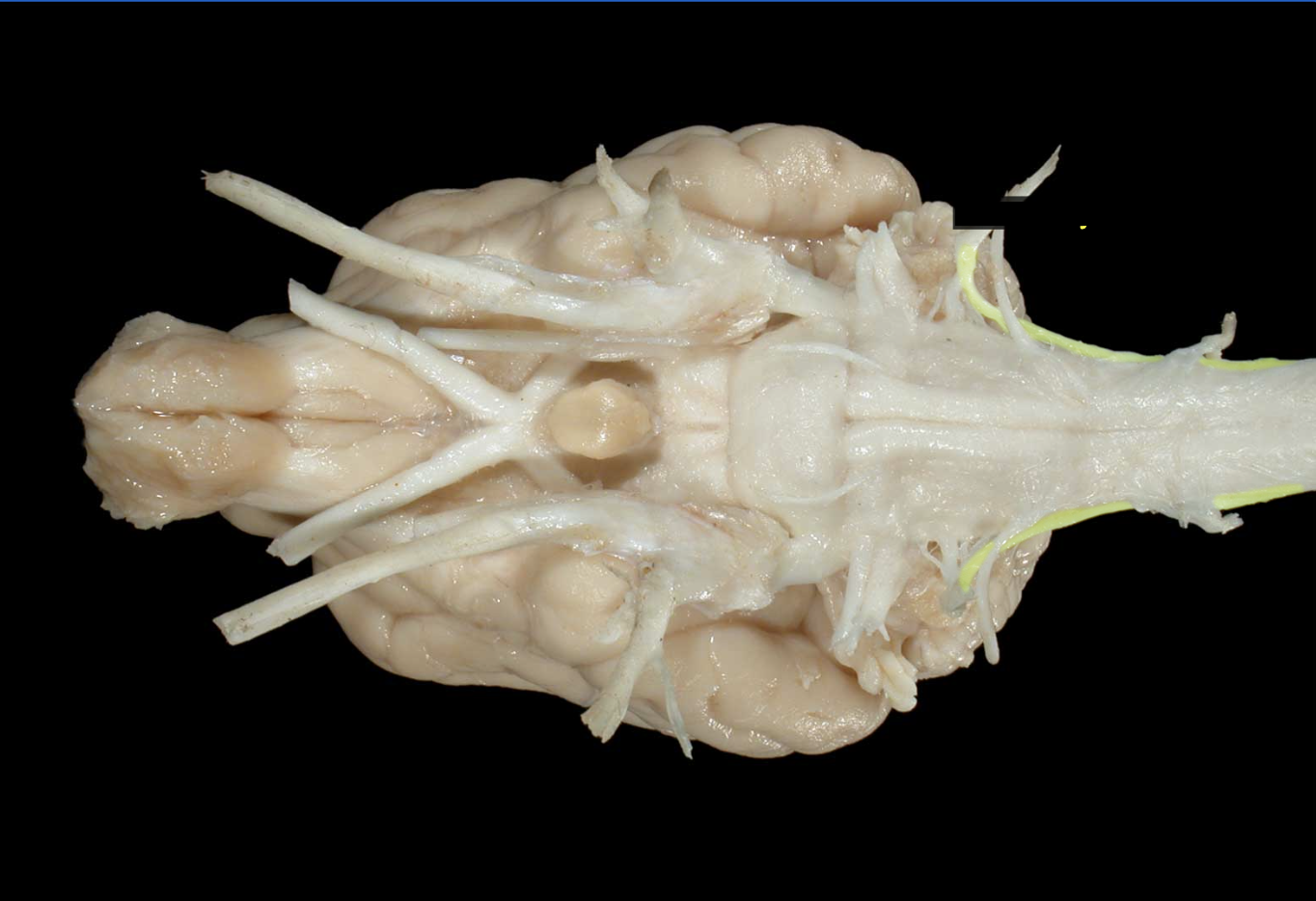 <p>what nerve is this</p>