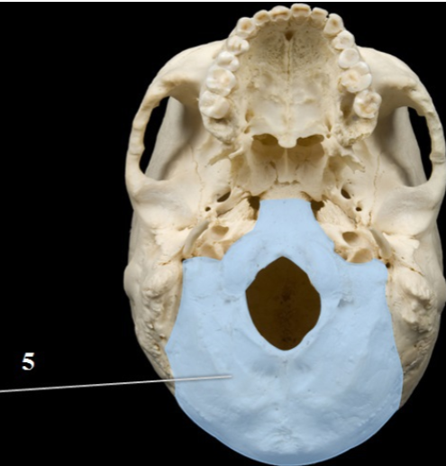 <p>Name This Bone</p>