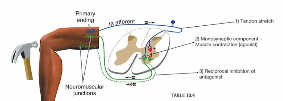 <p>Fast, automatic muscle action that has only one connection point, called a synapse, between a<strong> sensory nerve</strong> and a <strong>motor nerve.</strong></p><p></p><p>Deep tendon reflex such as the knee jerk is an example.</p><p>the brain can adjust this sensitivity</p>