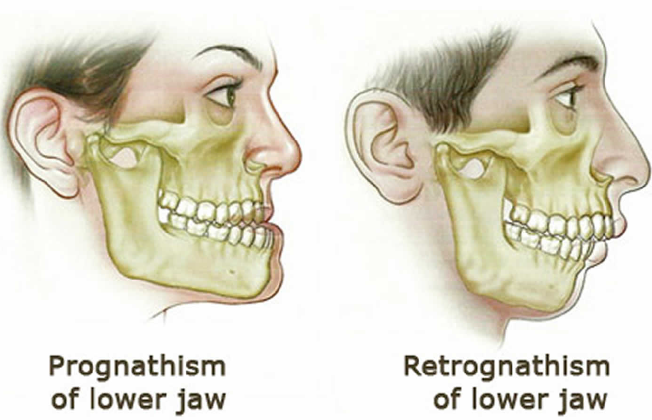<p>The mandible may be two things </p>