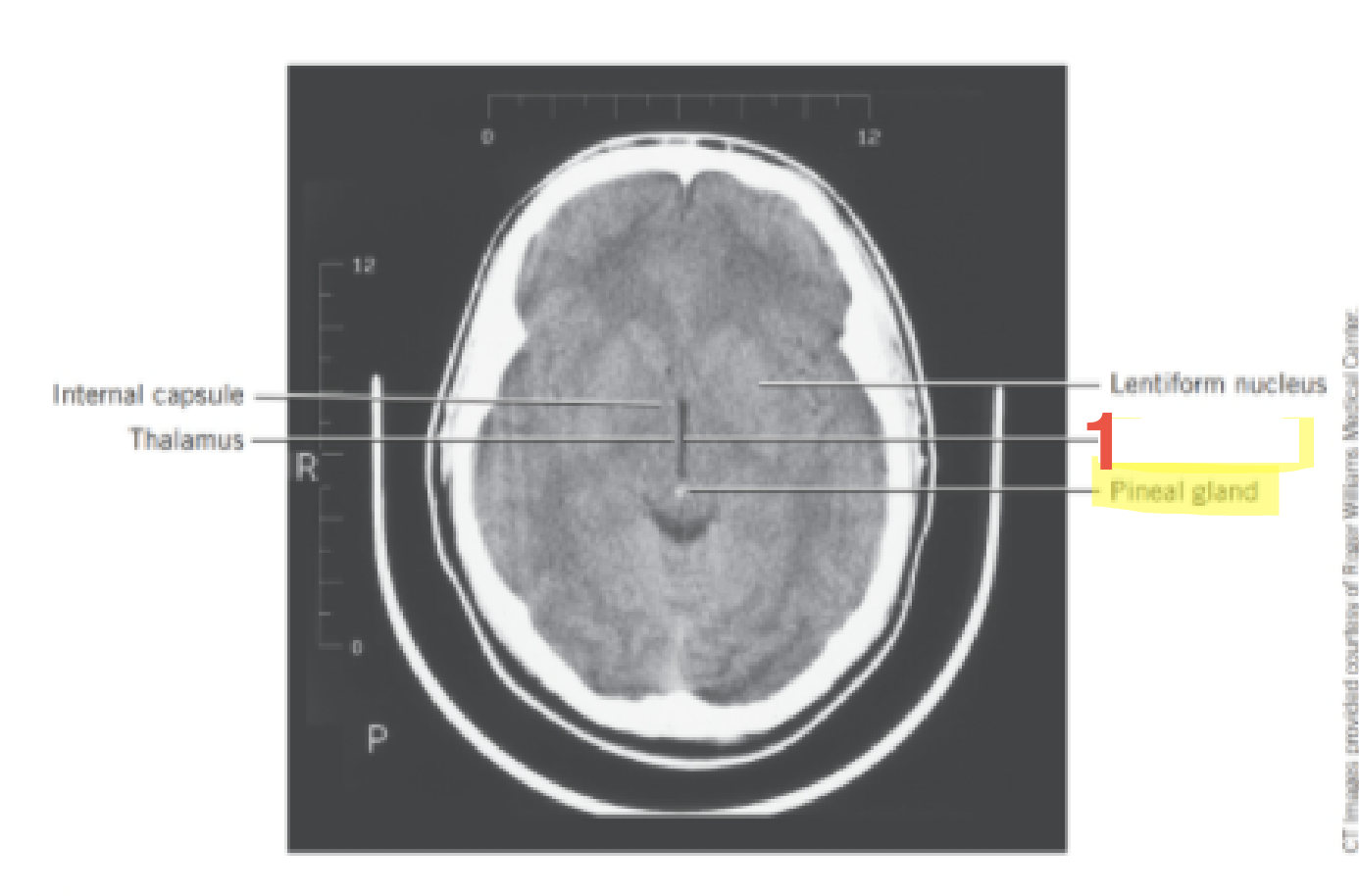 <p>1</p>