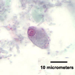 <p>Which intestinal flagellate is this?</p>
