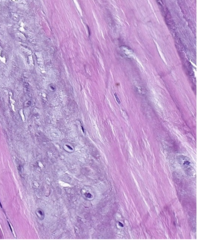 <p>What is the type of cartilage?</p>