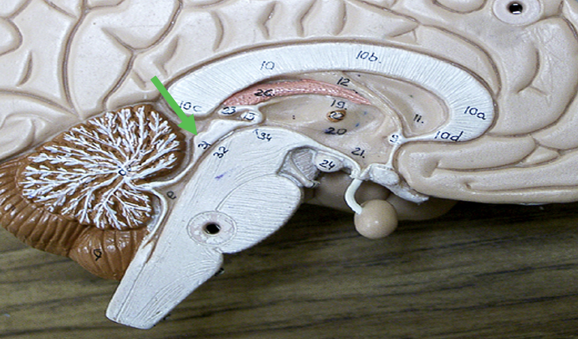 <p>Identify the area of the brain indicated by the pointer.</p>