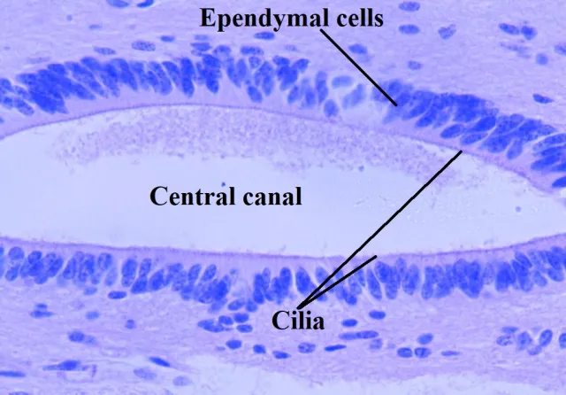 <p><strong>Ependymal cells</strong>: _______ cells that line _______ _____ _____ <span data-name="brain" data-type="emoji">🧠</span></p><p>Produce ________ fluid ( ____ )</p><p>______ circulate CSF to _____ <span data-name="bath" data-type="emoji">🛀</span> the brain &amp; spinal cord</p>