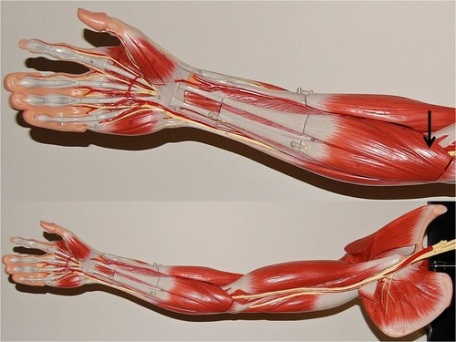<p>What muscle is this?</p>