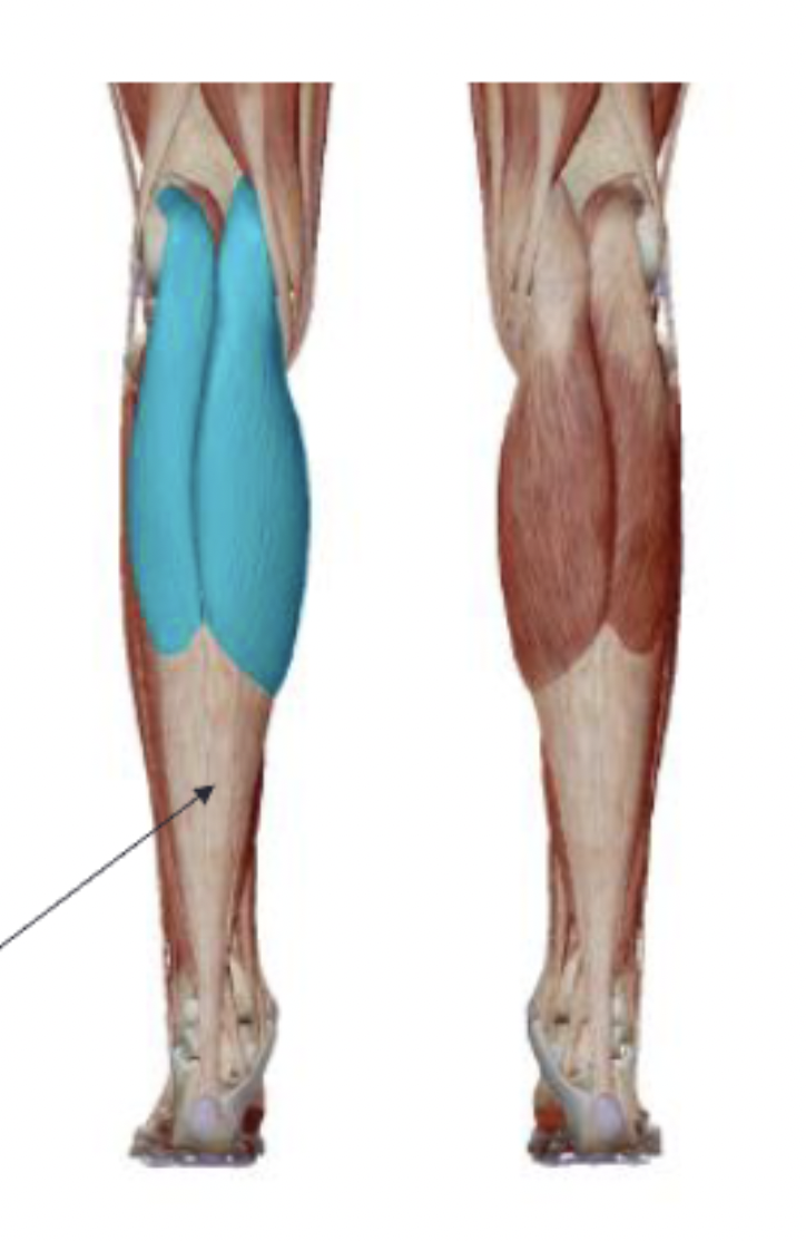 <p>What is the muscle name, its origin, its insertion, its action, and its innervation?</p>