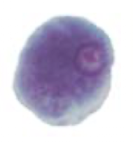 <p>What Amebae is this? Is this the trophozoite or cyst form?</p>