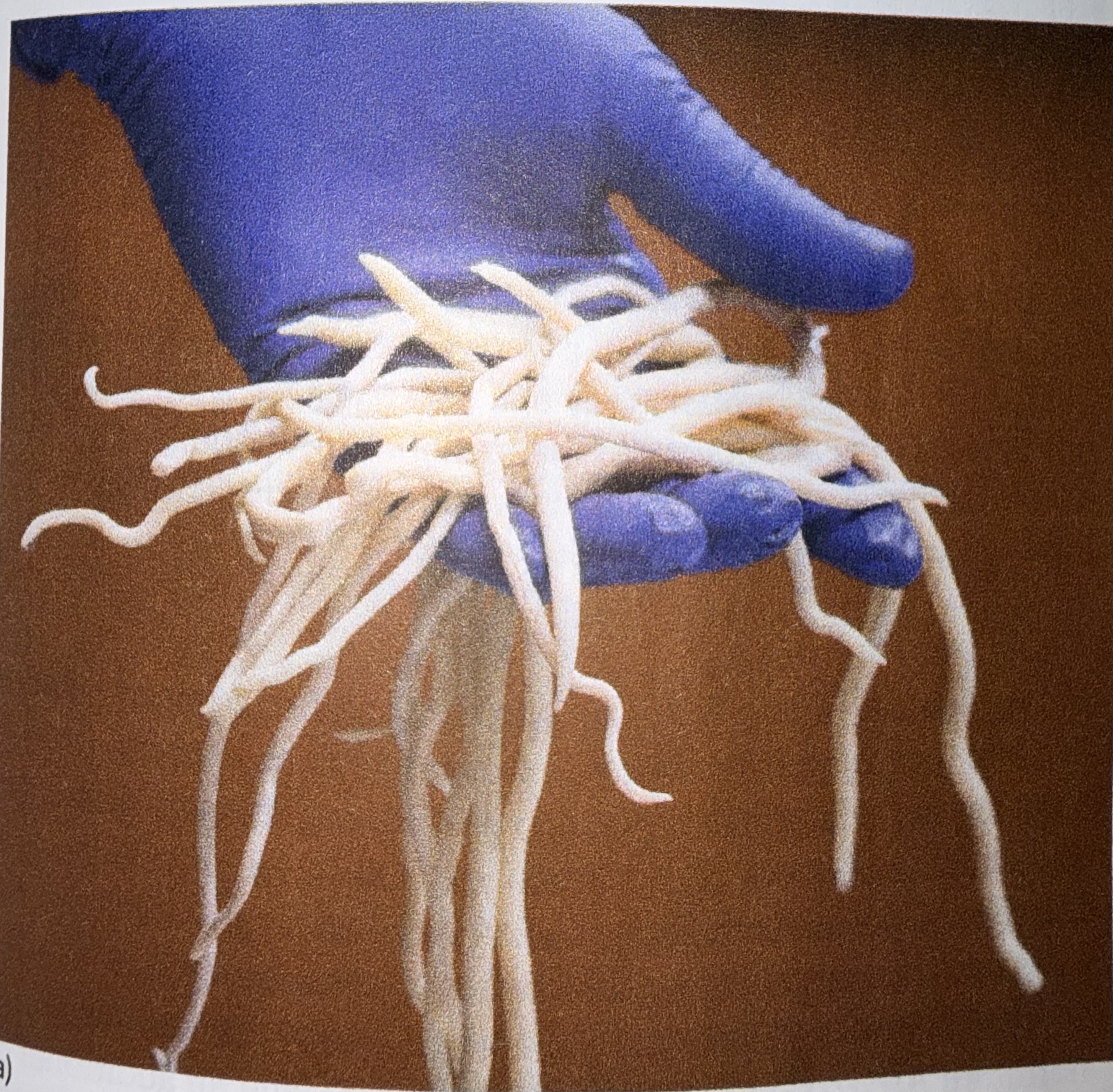 <p>*What type of helminth is this?</p>