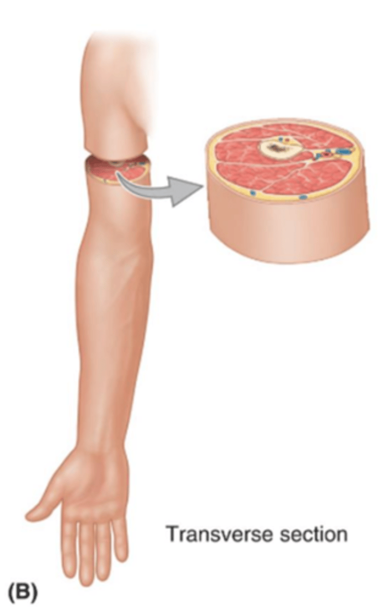 <p>cross section of a body part</p>