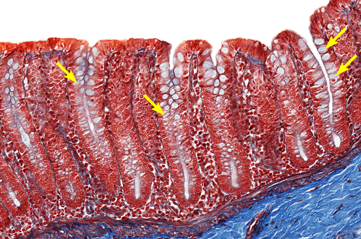<p>Colon</p><p><strong>NOTICE: THE LARGE NUMBER OF GOBLET CELLS WHICH ARE LIGHTER IN COLOR DUE TO THE WATER CONTENT NEEDED TO PROTECT FROM SOLID WASTE, THE MUCOSA ALSO HAS MORE UNIFORM RIDGES</strong></p>