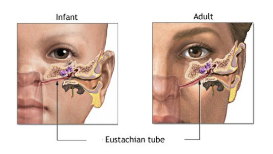 <p>They have a horizontal and shorter eustachian tube, so their ears are less able to drain fluids</p>