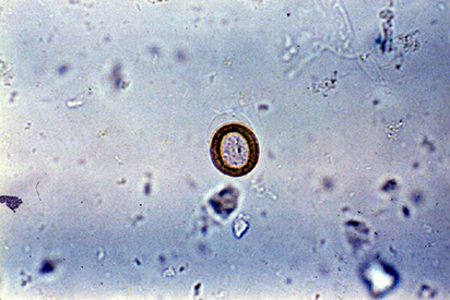 <p>Which parasite does the egg belong to?</p>