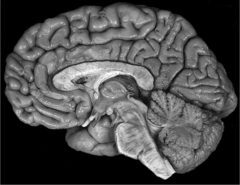 <p>What anatomical plane is the brain above shown in?</p><p>﻿﻿a. Axial </p><p>b. Sagittal</p><p>c. ﻿﻿Coronal</p><p>d. ﻿﻿Transverse</p>