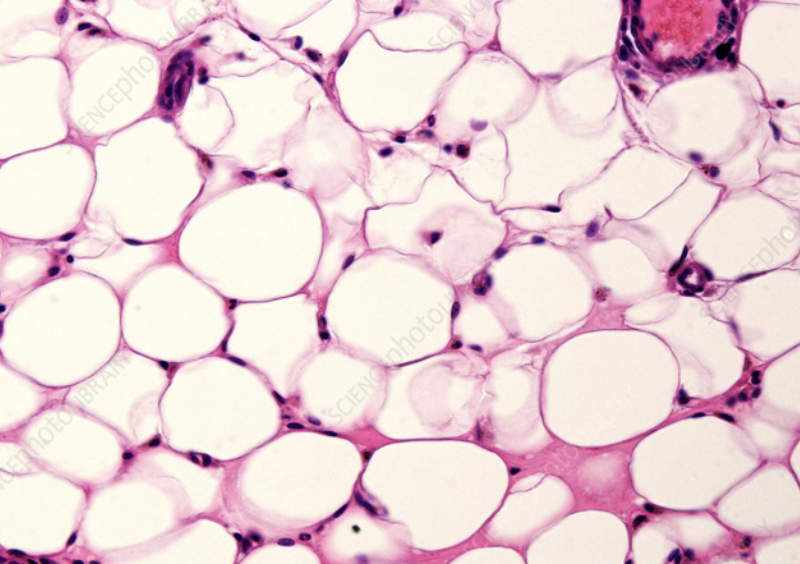 <p>has nuclear dots and large cells, energy source in areas with high oxygen</p>