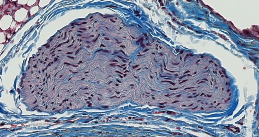 <p><span style="font-family: "Calibri Light";">Is this nerve fascicle myelinated or unmyelinated?</span></p>
