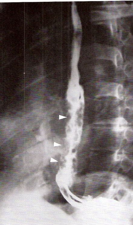 <p>diagnosis</p>