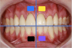 <p>Identify the quadrant in yellow</p>