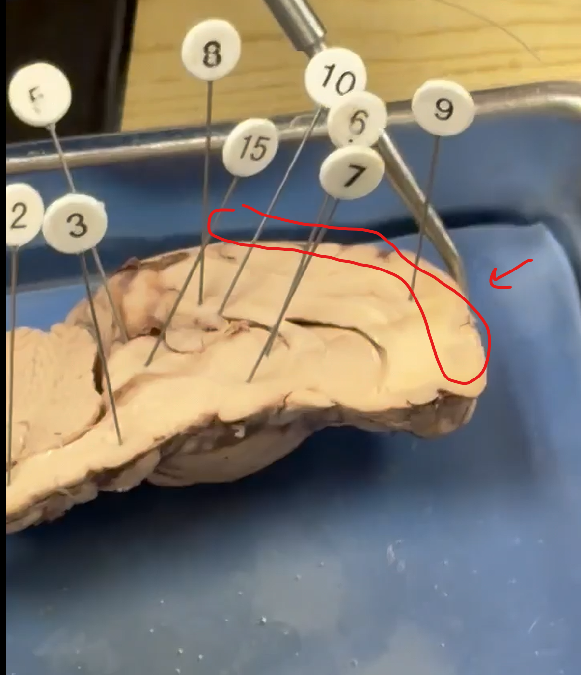 <p>Midline Cut: Structure?</p>