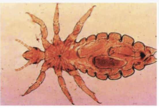 <p>Lice: Is this Mallophaga or Anoplura?</p>