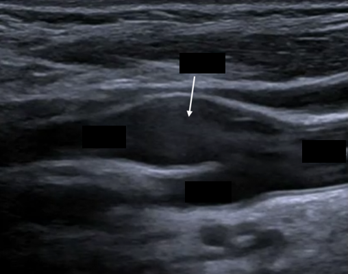 <p>In this picture, what is the arrow pointing at?</p>