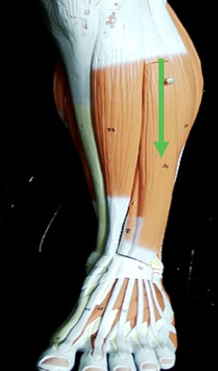 <p>Identify the muscle indicated by the pointer.</p>