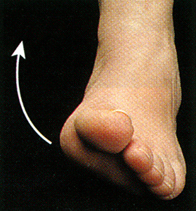 <p>What body movement is this? (Turning the sole of the foot inwards)</p>