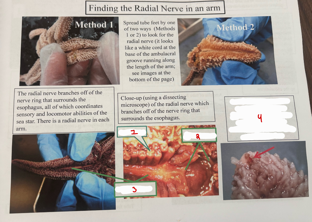 <p>Sea Stars Finding the Radial Nerve</p>