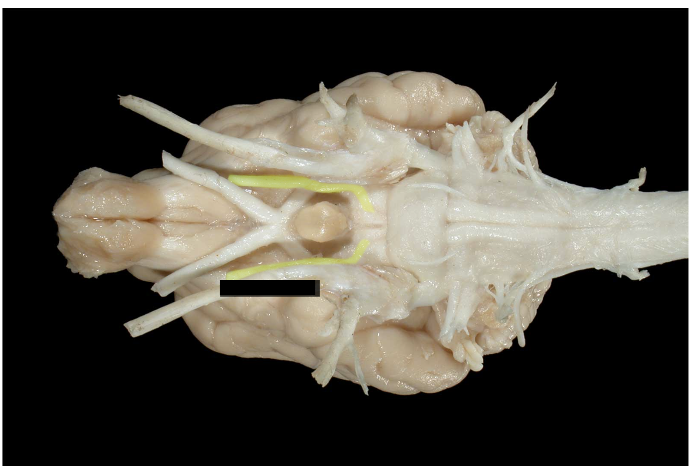 <p>what nerve is this</p>