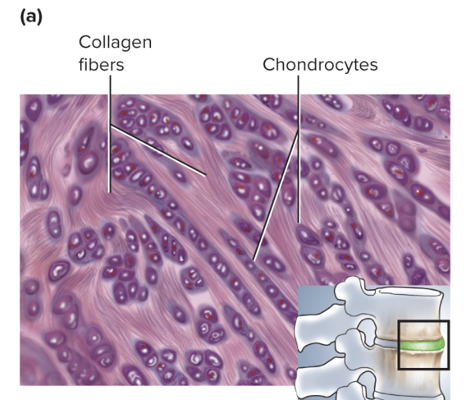 <p>Tough matrix with thick collagen fibers resisting compression</p>
