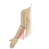 <p>What angle is this within the arm?</p>