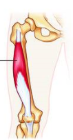 <p>A: extension at knee </p>