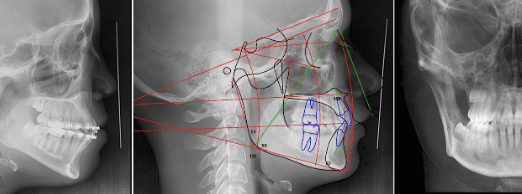 <p>what is a cephalometric x-ray?</p>