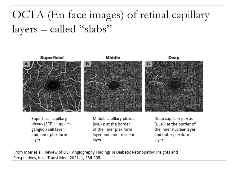 <p>OCTA provides en face, high‑resolution maps of the retinal:</p><ul><li><p>Superficial capillary plexus (SCP)</p></li><li><p>Middle capillary plexus (MCP)</p></li><li><p>Deep capillary plexus (DCP)</p></li></ul><p></p>