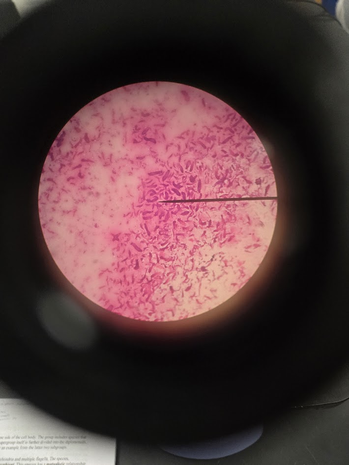 <ol><li><p>is this a protist or a bacteria?</p></li><li><p>what phylum is this?</p></li><li><p>what species is this species mutualistic with?</p></li></ol><p></p>