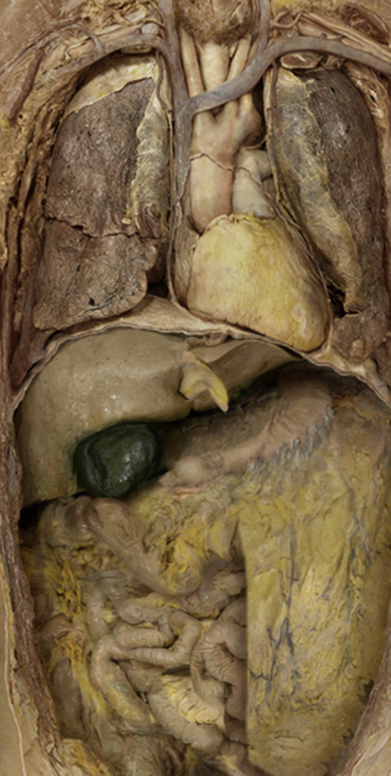 <p>Liver </p>
