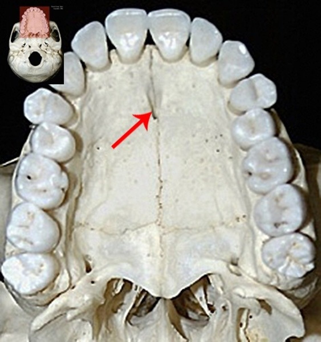 knowt flashcard image