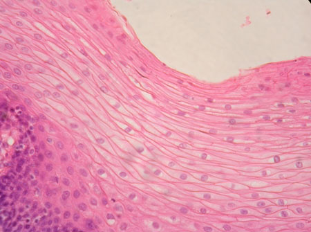 <p>-Function: Protects against abrasion, pathogens, and water loss</p><p>-Found: Skin, mouth, throat, esophagus</p><p>-Description: Multiple layers of cells; surface cells are flat</p>
