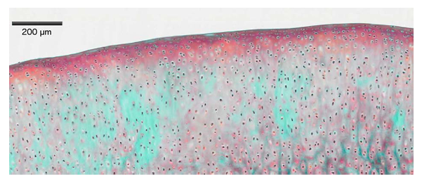 <p><strong><br>A18) Specify which statement is correct.</strong></p><p>A. The preparation shows articular cartilage </p><p>B. The preparation shows elastic cartilage </p><p>C. The tissue contains hydroxyapatite </p><p>D. The tissue is surrounded by a perichondrium </p><p>E. The cells seen secrete mainly collagen type I </p><p></p><p><em>Below is a tissue preparation that is stained with Masson-Goldner-Trichrome.</em></p>
