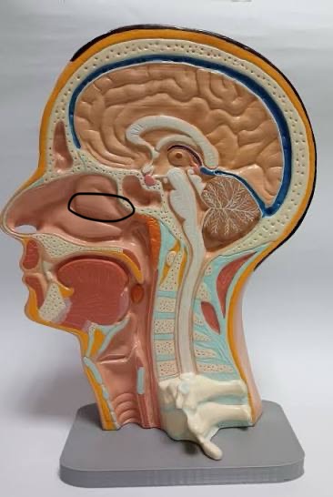 term image
