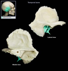<p>Portion of the temporal bone surrounding the ear canal</p>